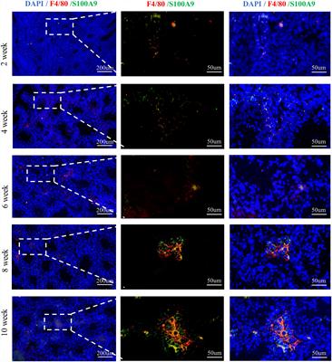 S100A9 Activates the Immunosuppressive Switch Through the PI3K/Akt Pathway to Maintain the Immune Suppression Function of Testicular Macrophages